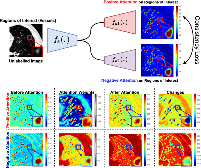 Figure 3 for Learning Morphological Feature Perturbations for Calibrated Semi-Supervised Segmentation