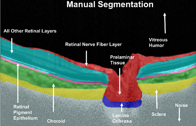 Figure 1 for DRUNET: A Dilated-Residual U-Net Deep Learning Network to Digitally Stain Optic Nerve Head Tissues in Optical Coherence Tomography Images