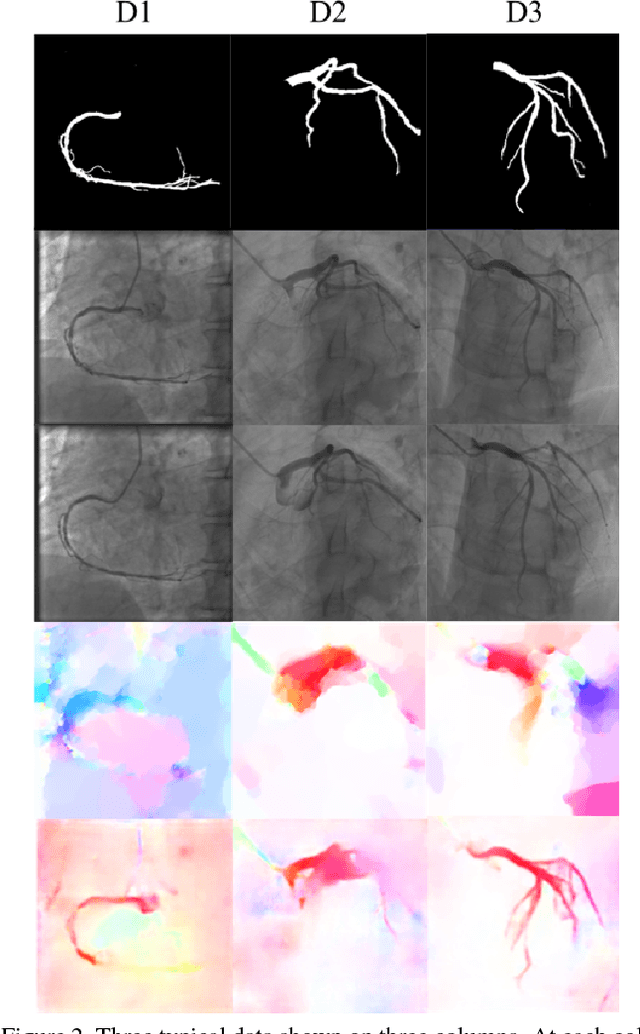 Figure 2 for Flow Based Self-supervised Pixel Embedding for Image Segmentation