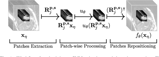 Figure 1 for Neural Networks-based Regularization for Large-Scale Medical Image Reconstruction