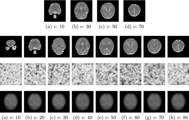 Figure 2 for Flexible Conditional Image Generation of Missing Data with Learned Mental Maps