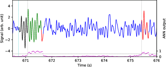 Figure 2 for The Portiloop: a deep learning-based open science tool for closed-loop brain stimulation