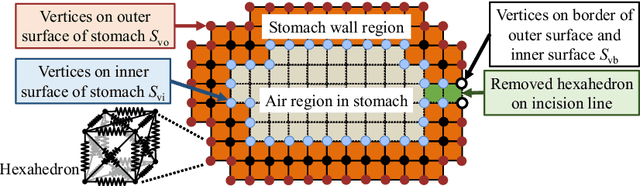 Figure 1 for Semi-automated Virtual Unfolded View Generation Method of Stomach from CT Volumes