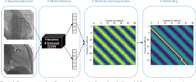 Figure 1 for End-to-End Deep Learning Model for Cardiac Cycle Synchronization from Multi-View Angiographic Sequences
