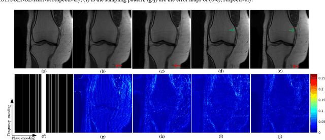 Figure 3 for pISTA-SENSE-ResNet for Parallel MRI Reconstruction
