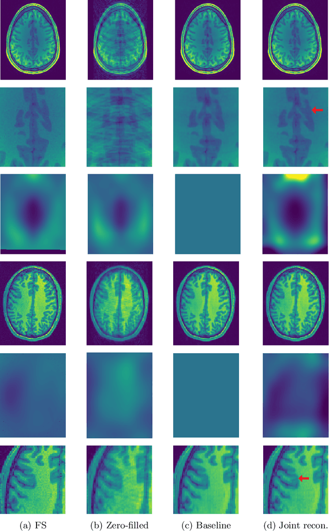 Figure 1 for Joint reconstruction and bias field correction for undersampled MR imaging