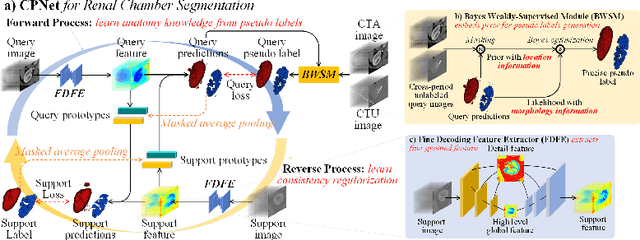 Figure 3 for CPNet: Cycle Prototype Network for Weakly-supervised 3D Renal Compartments Segmentation on CT Images