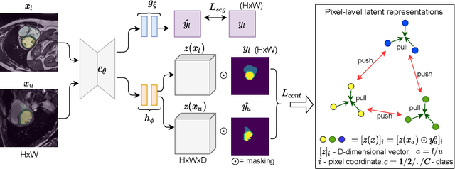 Figure 2 for Local contrastive loss with pseudo-label based self-training for semi-supervised medical image segmentation