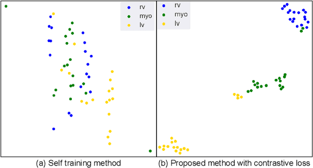 Figure 3 for Local contrastive loss with pseudo-label based self-training for semi-supervised medical image segmentation