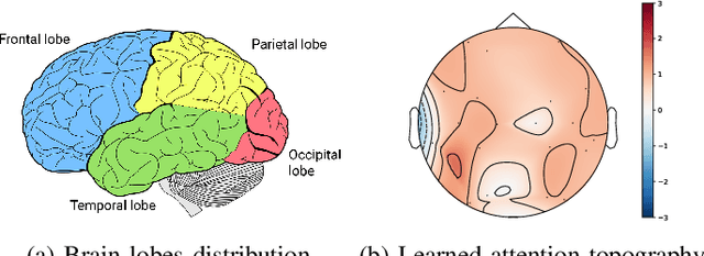 Figure 4 for Adversarial Representation Learning for Robust Patient-Independent Epileptic Seizure Detection