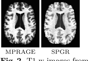 Figure 2 for Contrast Adaptive Tissue Classification by Alternating Segmentation and Synthesis