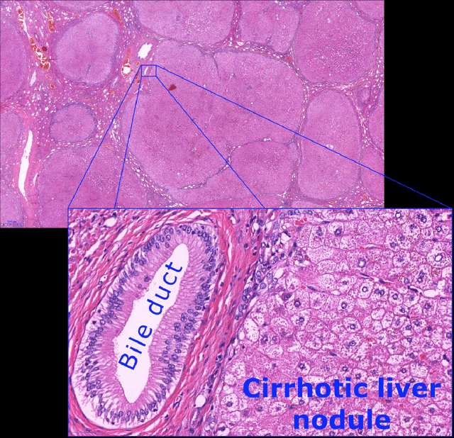 Figure 4 for Towards the Augmented Pathologist: Challenges of Explainable-AI in Digital Pathology