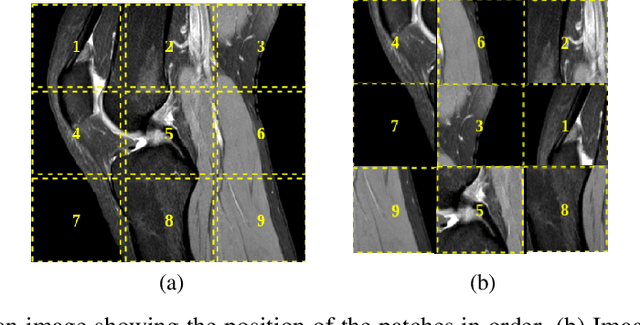 Figure 1 for SSLM: Self-Supervised Learning for Medical Diagnosis from MR Video