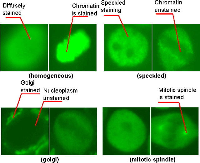 Figure 1 for Discovering Discriminative Cell Attributes for HEp-2 Specimen Image Classification
