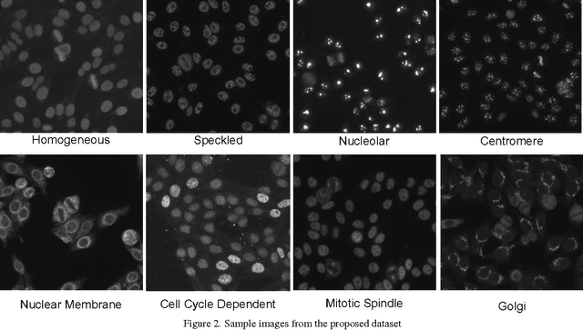 Figure 2 for Discovering Discriminative Cell Attributes for HEp-2 Specimen Image Classification