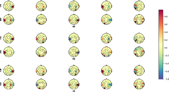 Figure 4 for Temporal EigenPAC for dyslexia diagnosis