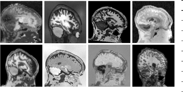 Figure 3 for SynthStrip: Skull-Stripping for Any Brain Image