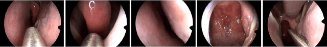 Figure 1 for Learning Representations of Endoscopic Videos to Detect Tool Presence Without Supervision
