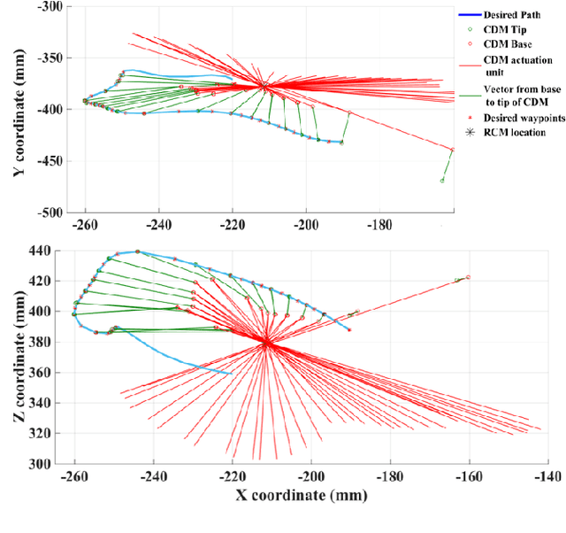Figure 4 for A Convex Optimization Framework for Constrained Concurrent Motion Control of a Hybrid Redundant Surgical System