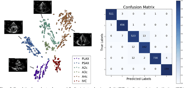 Figure 3 for A Computer Vision Pipeline for Automated Determination of Cardiac Structure and Function and Detection of Disease by Two-Dimensional Echocardiography