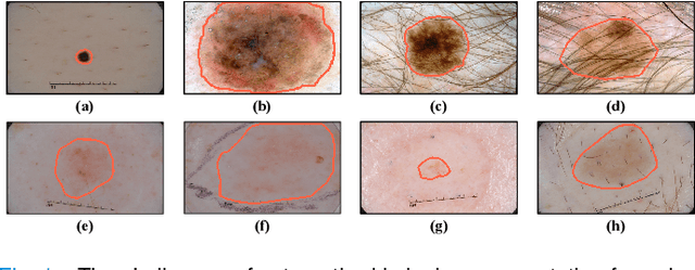 Figure 1 for XBound-Former: Toward Cross-scale Boundary Modeling in Transformers