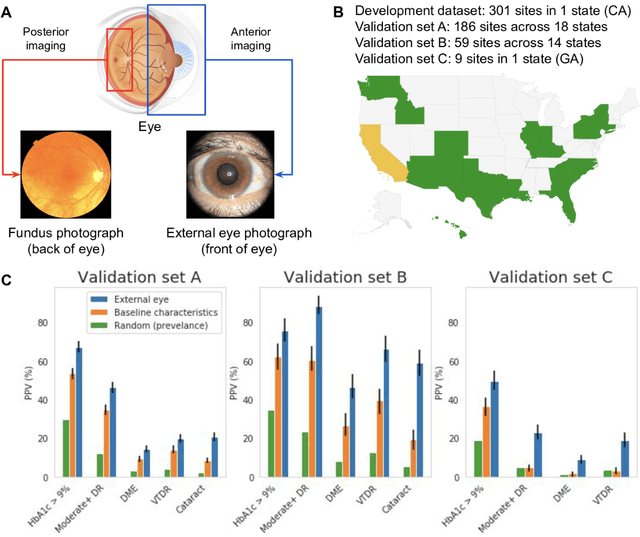Figure 1 for Detecting hidden signs of diabetes in external eye photographs