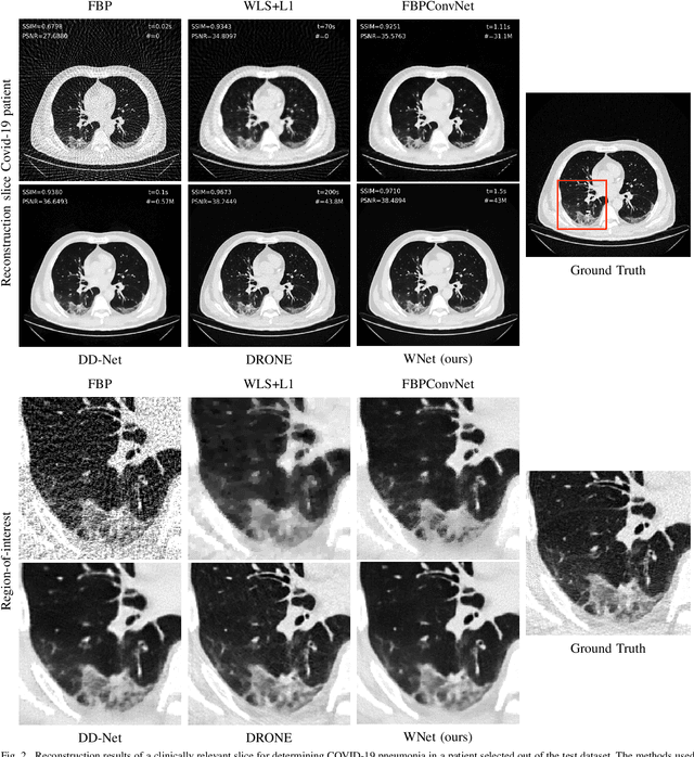 Figure 2 for WNet: A data-driven dual-domain denoising model for sparse-view computed tomography with a trainable reconstruction layer