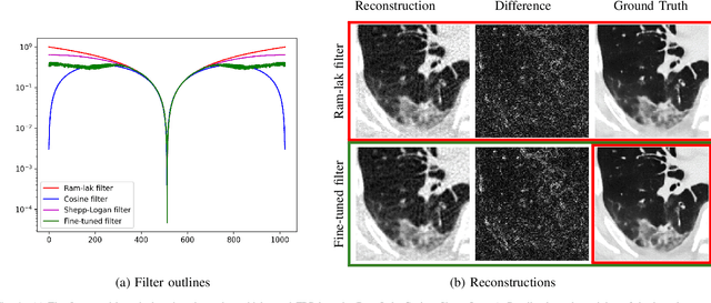 Figure 4 for WNet: A data-driven dual-domain denoising model for sparse-view computed tomography with a trainable reconstruction layer