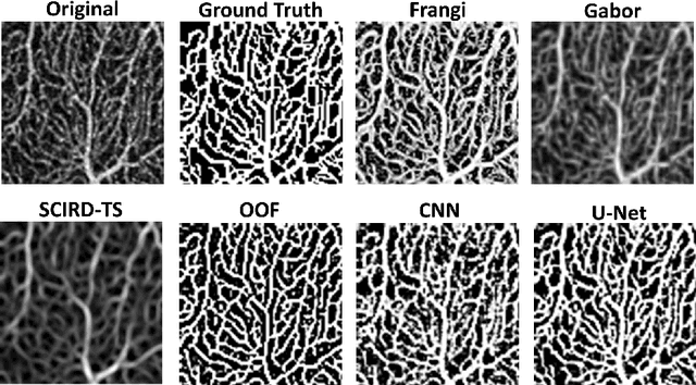 Figure 2 for Automated and Network Structure Preserving Segmentation of Optical Coherence Tomography Angiograms