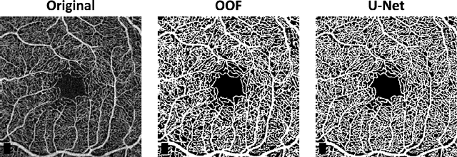 Figure 4 for Automated and Network Structure Preserving Segmentation of Optical Coherence Tomography Angiograms