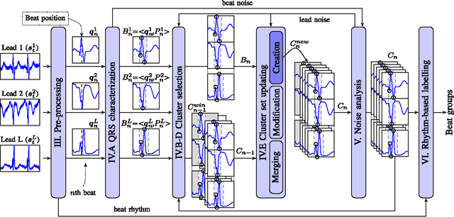 Figure 1 for A method for context-based adaptive QRS clustering in real-time