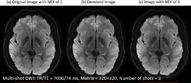 Figure 4 for Review: Noise and artifact reduction for MRI using deep learning