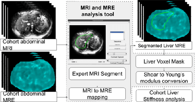 Figure 2 for Patient Specific Biomechanics Are Clinically Significant In Accurate Computer Aided Surgical Image Guidance