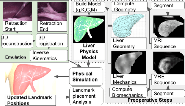 Figure 3 for Patient Specific Biomechanics Are Clinically Significant In Accurate Computer Aided Surgical Image Guidance