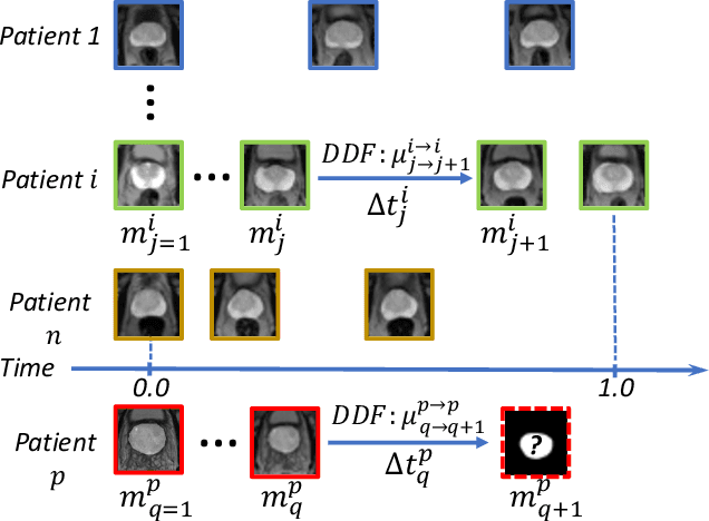 Figure 2 for Morphological Change Forecasting for Prostate Glands using Feature-based Registration and Kernel Density Extrapolation