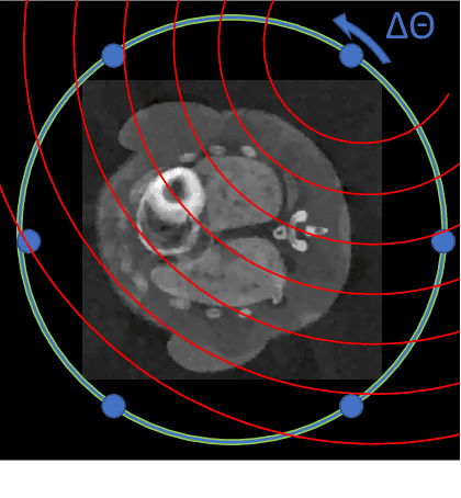 Figure 3 for A Memory-Efficient Dynamic Image Reconstruction Method using Neural Fields