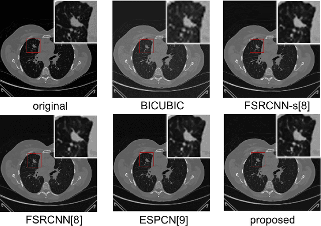 Figure 4 for Computed Tomography Image Enhancement using 3D Convolutional Neural Network