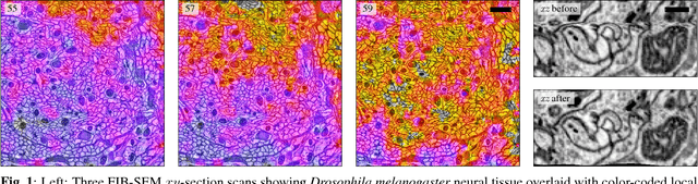 Figure 1 for Image-Based Correction of Continuous and Discontinuous Non-Planar Axial Distortion in Serial Section Microscopy