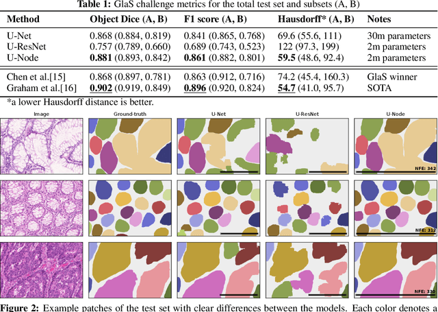 Figure 2 for Neural Ordinary Differential Equations for Semantic Segmentation of Individual Colon Glands