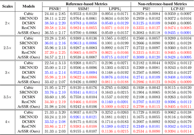 Figure 2 for An Arbitrary Scale Super-Resolution Approach for 3-Dimensional Magnetic Resonance Image using Implicit Neural Representation