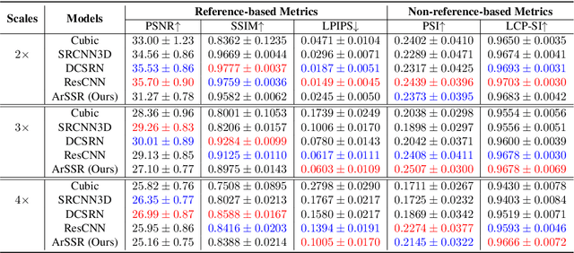 Figure 4 for An Arbitrary Scale Super-Resolution Approach for 3-Dimensional Magnetic Resonance Image using Implicit Neural Representation
