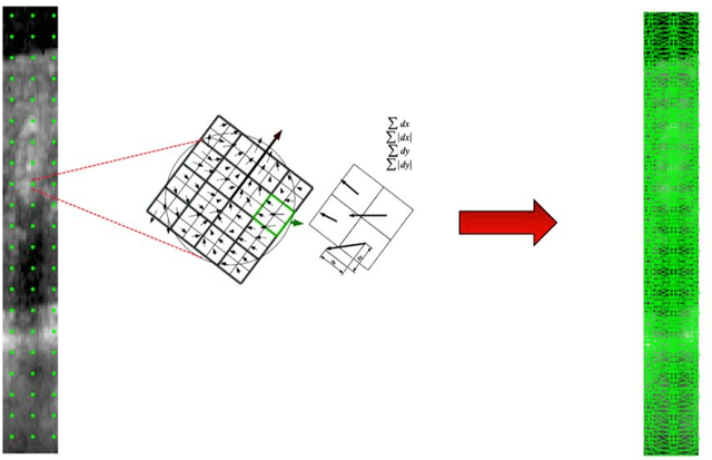 Figure 4 for Automatic Detection of Microaneurysms in OCT Images Using Bag of Features