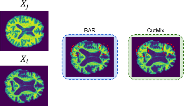 Figure 3 for Brain-Aware Replacements for Supervised Contrastive Learning