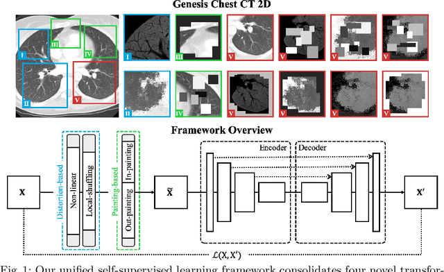 Figure 2 for Models Genesis: Generic Autodidactic Models for 3D Medical Image Analysis