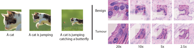 Figure 1 for Improving Whole Slide Segmentation Through Visual Context - A Systematic Study