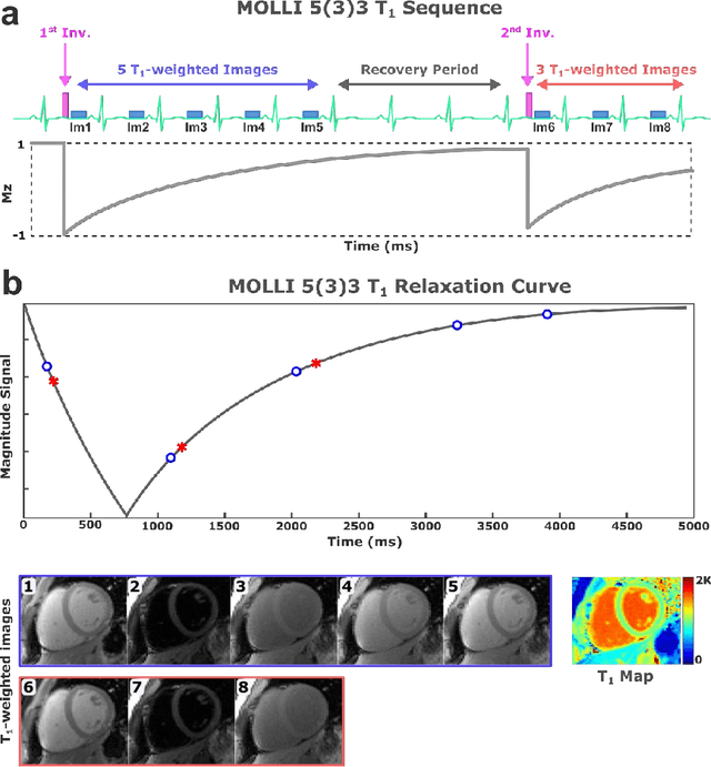 Figure 1 for $\textbf{MyoMapNet}$: Accelerated Modified Look-Locker Inversion Recovery Myocardial T1 Mapping via Neural Networks