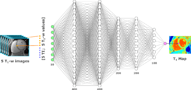 Figure 3 for $\textbf{MyoMapNet}$: Accelerated Modified Look-Locker Inversion Recovery Myocardial T1 Mapping via Neural Networks