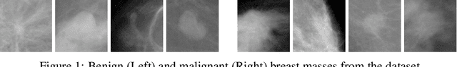 Figure 1 for Breast Mass Classification from Mammograms using Deep Convolutional Neural Networks