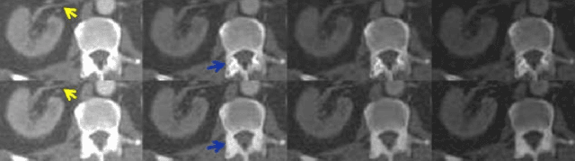 Figure 3 for Direct Energy-resolving CT Imaging via Energy-integrating CT images using a Unified Generative Adversarial Network
