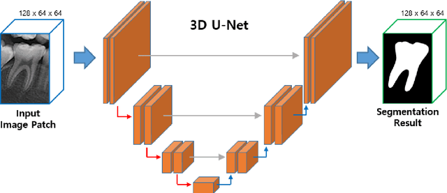 Figure 3 for Tooth Instance Segmentation from Cone-Beam CT Images through Point-based Detection and Gaussian Disentanglement